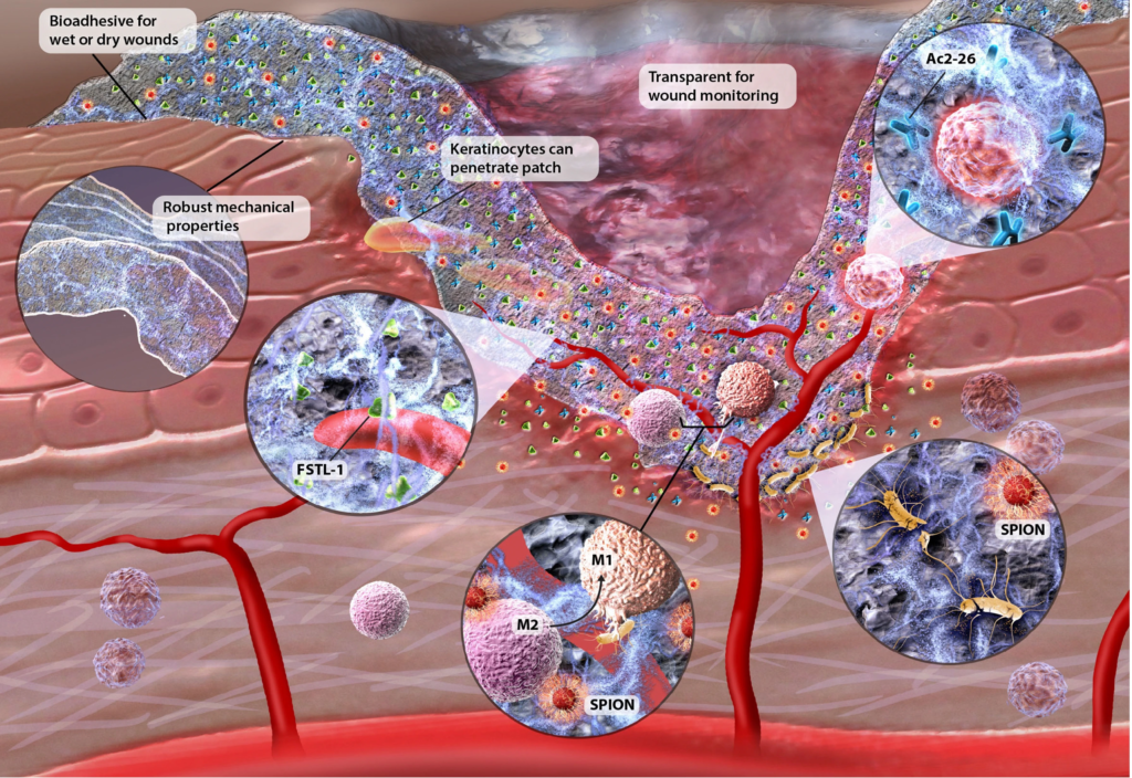 chronic wound treatment